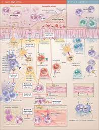 Biologic Therapies for Severe Asthma | NEJM
